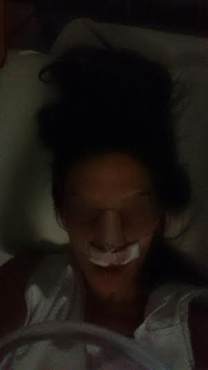  Σοκ στη Θεσσαλονίκη: Τραγουδίστρια αφαίρεσε όγκο από τη μύτη[VIDEO]